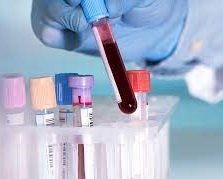 Blood Analysis Point of Care Testing Nigeria