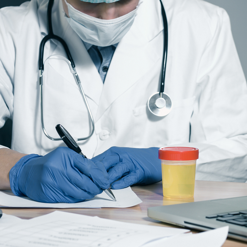 Point-of-Care urine Testing in Abuja, Nigeria | Urine test in Abuja